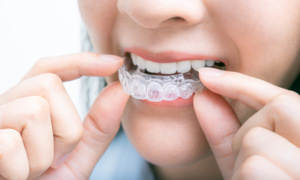 Why Invisalign Trays Feel Tight at Night and What It Means