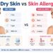 dry skin vs skin allergy